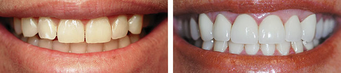  Profile Photos of Lakefront Family Dentistry | Derek Hauser, DDS 31571 Canyon Estates Dr #117 - Photo 8 of 11