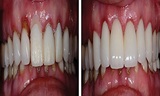  Lakefront Family Dentistry | Derek Hauser, DDS 31571 Canyon Estates Dr #117 