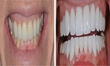  Lakefront Family Dentistry | Derek Hauser, DDS 31571 Canyon Estates Dr #117 