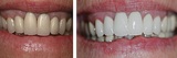  Lakefront Family Dentistry | Derek Hauser, DDS 31571 Canyon Estates Dr #117 