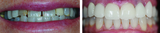  Lakefront Family Dentistry | Derek Hauser, DDS 31571 Canyon Estates Dr #117 