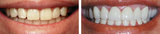  Lakefront Family Dentistry | Derek Hauser, DDS 31571 Canyon Estates Dr #117 