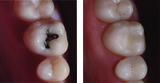  Lakefront Family Dentistry | Derek Hauser, DDS 31571 Canyon Estates Dr #117 