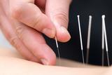Serenity Acupuncture & Wellness Clinic, Cornelius