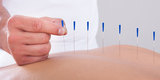  City Acupuncture Fulton Street, New York City 139 Fulton Street #207, New York, NY - 10038 
