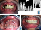 The Prefect Smile Dental Clinic, Chandigarh, Chandigarh
