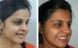 The Prefect Smile Dental Clinic, Chandigarh, Chandigarh