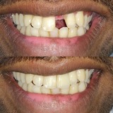 The Prefect Smile Dental Clinic, Chandigarh, Chandigarh