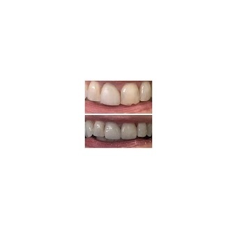  Profile Photos of Dover Dental 601 Dover Drive - Photo 3 of 4