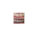 Dover Dental, Newport Beach