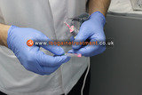 Ibogaine treatment london<br />
 Ibogaine Treatment Center Sremskih boraca 2e 