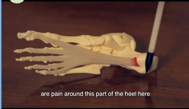  Sydney Heel Pain of Sydney Heel Pain North Sydney Doctors, Level 1, Belvedere Building, 138 Little Walker St - Photo 1 of 3