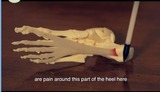 Sydney Heel Pain, North Sydney