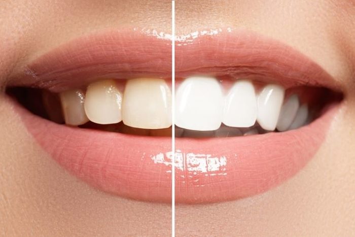  Profile Photos of East Wind Dental Care (Hillsboro Dentist) 7546 NE Shaleen St - Photo 1 of 1