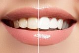 East Wind Dental Care (Hillsboro Dentist), Hillsboro