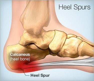  The Heel Clinic of The Heel Clinic 88 Phillip St - Photo 1 of 3