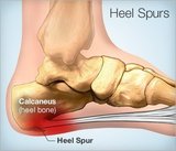 The Heel Clinic, Sydney