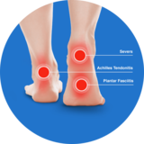 The Heel Clinic, Sydney