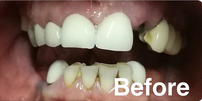  Profile Photos of Top Dental Care Suite # 12 Centro Comercial Plaza La Carpintera, Curridabat. - Photo 1 of 5