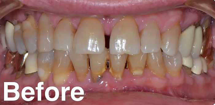  Profile Photos of Top Dental Care Suite # 12 Centro Comercial Plaza La Carpintera, Curridabat. - Photo 2 of 5