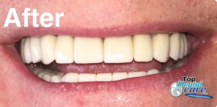  Profile Photos of Top Dental Care Suite # 12 Centro Comercial Plaza La Carpintera, Curridabat. - Photo 3 of 5