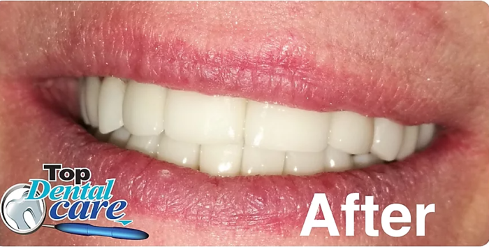  Profile Photos of Top Dental Care Suite # 12 Centro Comercial Plaza La Carpintera, Curridabat. - Photo 4 of 5