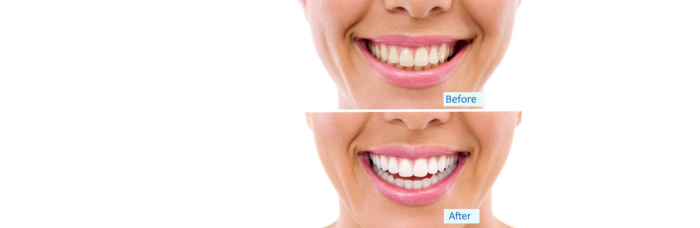  Profile Photos of Bliss Dental - General Dentist specializing in Veneers, Smile Makeover 8501 SW 124th Ave #104 - Photo 4 of 4