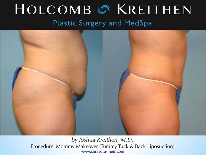  New Album of Holcomb - Kreithen Plastic Surgery & MedSpa 1 S. School Ave, Ste 800 - Photo 1 of 4