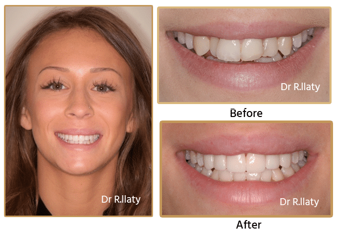  New Album of Surrey DentalSpa Surrey Dental Spa 421 London Road North Cheam Surrey, SM3 8JN - Photo 4 of 4