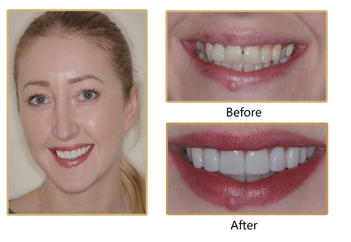  New Album of Surrey DentalSpa Surrey Dental Spa 421 London Road North Cheam Surrey, SM3 8JN - Photo 1 of 4