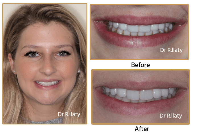  New Album of Surrey DentalSpa Surrey Dental Spa 421 London Road North Cheam Surrey, SM3 8JN - Photo 2 of 4