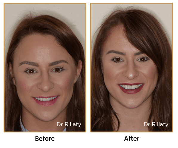  New Album of Surrey DentalSpa Surrey Dental Spa 421 London Road North Cheam Surrey, SM3 8JN - Photo 3 of 4
