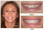  Surrey DentalSpa Surrey Dental Spa 421 London Road North Cheam Surrey, SM3 8JN 