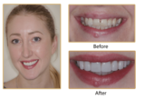  Surrey DentalSpa Surrey Dental Spa 421 London Road North Cheam Surrey, SM3 8JN 