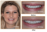  Surrey DentalSpa Surrey Dental Spa 421 London Road North Cheam Surrey, SM3 8JN 