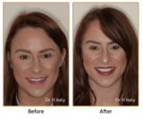  Surrey DentalSpa Surrey Dental Spa 421 London Road North Cheam Surrey, SM3 8JN 