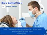 Dentist In Bangalore, Diva Dental Care, Wilson Garden Bengaluru