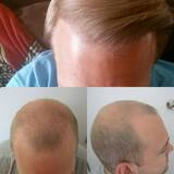  Hair Repair Cancun. Plaza Mayatlan #8 