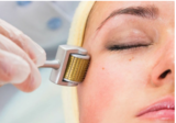 Microneedling NZ, Christchurch