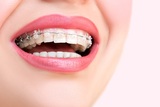 Toothkind Dental Jimboomba, Jimboomba