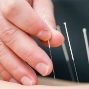  Profile Photos of Acupuncture Health Care Center 330 E 85th St, #C - Photo 4 of 4