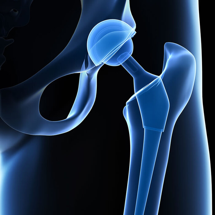  Profile Photos of Cape Hip and Knee 3rd Floor Life Orthopaedic Hospital, Alexandra Rd, Pinelands - Photo 3 of 7