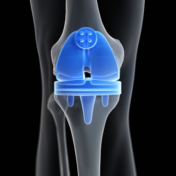 Profile Photos of Cape Hip and Knee 3rd Floor Life Orthopaedic Hospital, Alexandra Rd, Pinelands - Photo 4 of 7