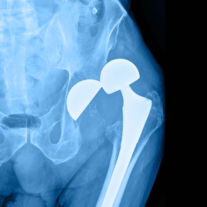 Profile Photos of Cape Hip and Knee 3rd Floor Life Orthopaedic Hospital, Alexandra Rd, Pinelands - Photo 5 of 7