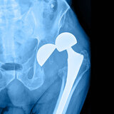  Cape Hip and Knee 3rd Floor Life Orthopaedic Hospital, Alexandra Rd, Pinelands 
