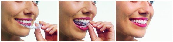  Profile Photos of Share A Smile Orthodontics 63 Eastern Road - Photo 2 of 4