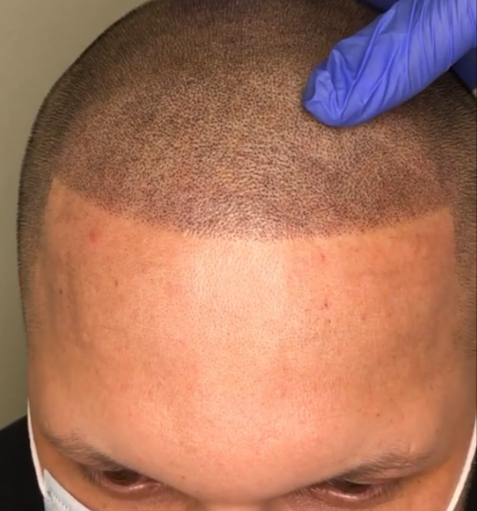  Profile Photos of ScalpMicro Tampa Bay 2726 Windguard Circle - Photo 5 of 6