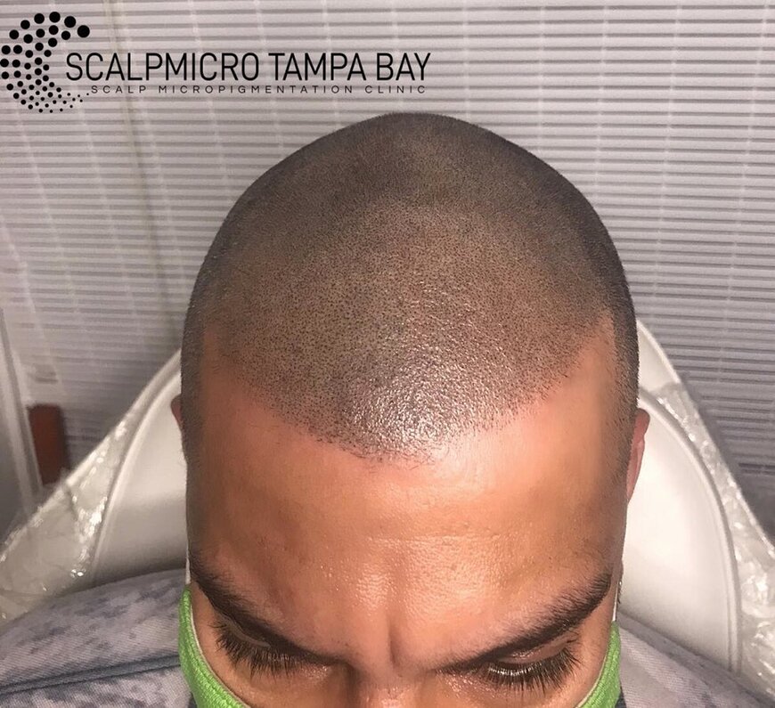  Pricelists of ScalpMicro Tampa Bay 2726 Windguard Circle - Photo 5 of 6