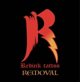 Redink Tattoo Removal, New York