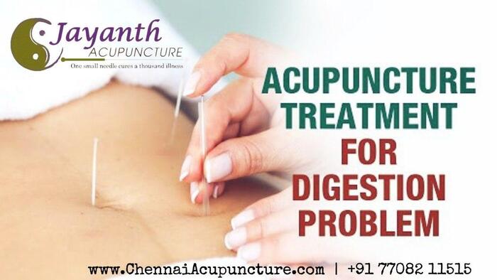 Acupuncture Treatment For Digestion Problems in Chennai Near Me - The Best Acupuncture Clinic Acupuncture Treatment of Chennai Jayanth Acupuncture Clinic #77, Harrington Road, Chetpet - Photo 30 of 42 Acupuncture Treatment For Digestion Problems in Chennai Near Me - The Best Acupuncture Clinic Acupuncture Treatment of Chennai Jayanth Acupuncture Clinic #77, Harrington Road, Chetpet - Photo 30 of 42